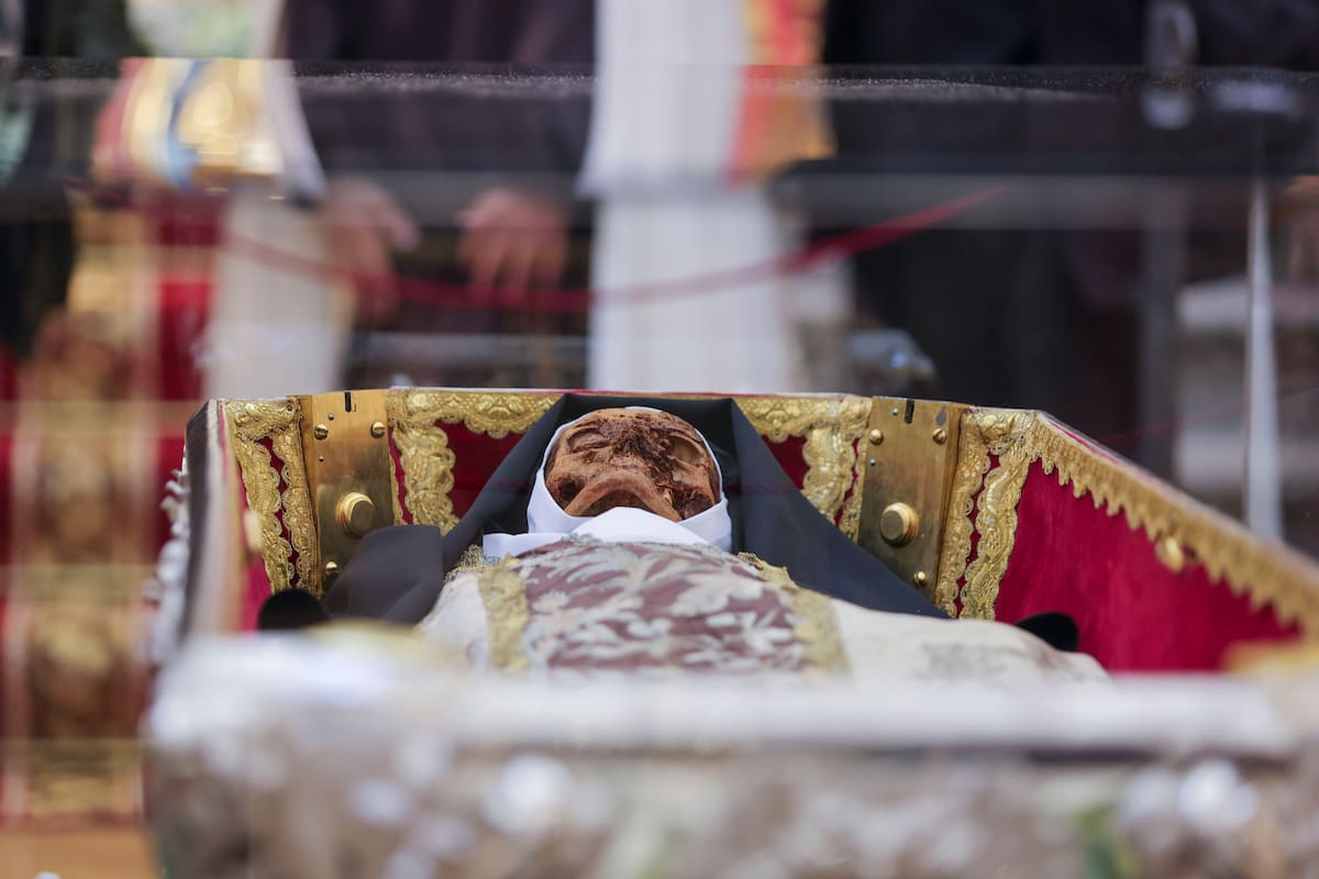 Revelan impactantes fotos del cadáver de Santa Teresa: así luce el cuerpo