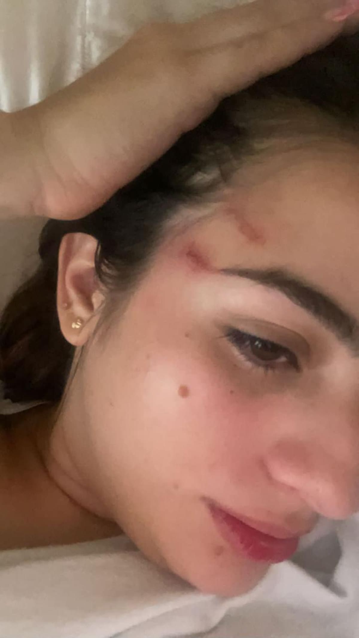 Fiorella Capella Dager, tras ser agredida por su expareja el 7 de noviembre de 2021. // Foto: cortesia