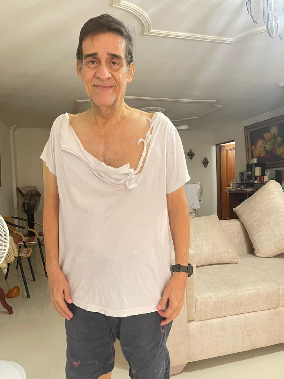 Luis Edgardo Capella Castor, padre de Fiorella, tras ser agredido el 7 de noviembre de 2021 por la expareja de su hija. // Foto: cortesia