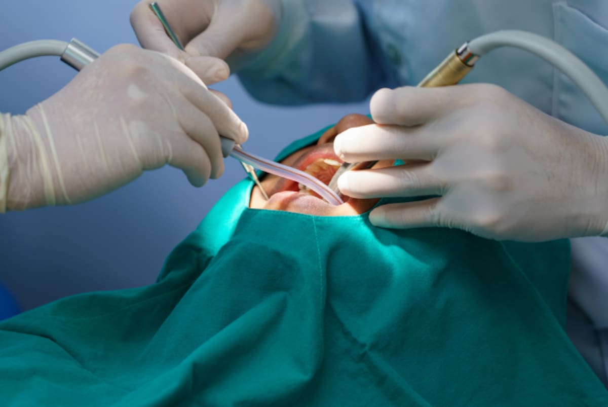 Foto de referencia de una cirugía bucal. // Foto: Shutterstock