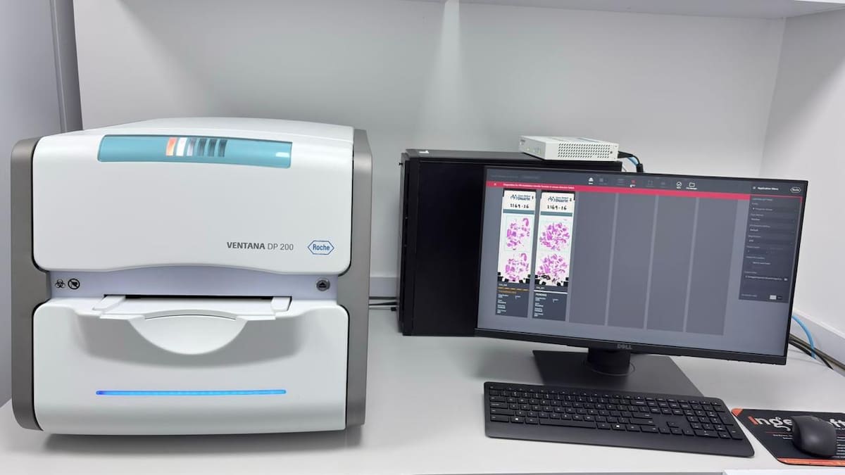 Estas son las máquinas donde los laboratorios envían las imágenes escaneadas para que los expertos las puedan analizar y diagnosticar con tiempo. // Foto: cortesía.