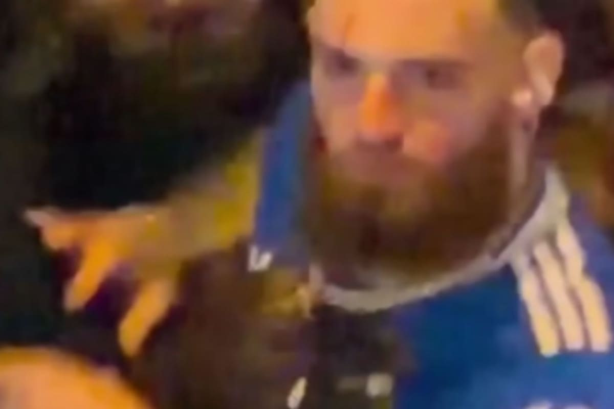 Hades 66 resulta herido tras recibir un vaso de cristal en la cara durante concierto