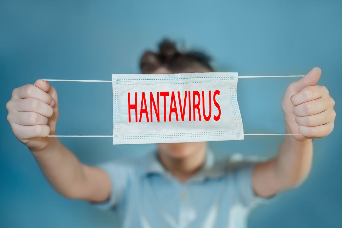 Conoce los síntomas de este virus que puede ser letal para los portadores // 123RF.