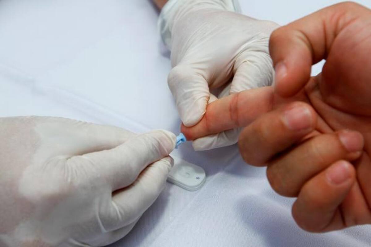 Las recomendaciones del INS al Dadis ante alerta por hepatitis aguda grave