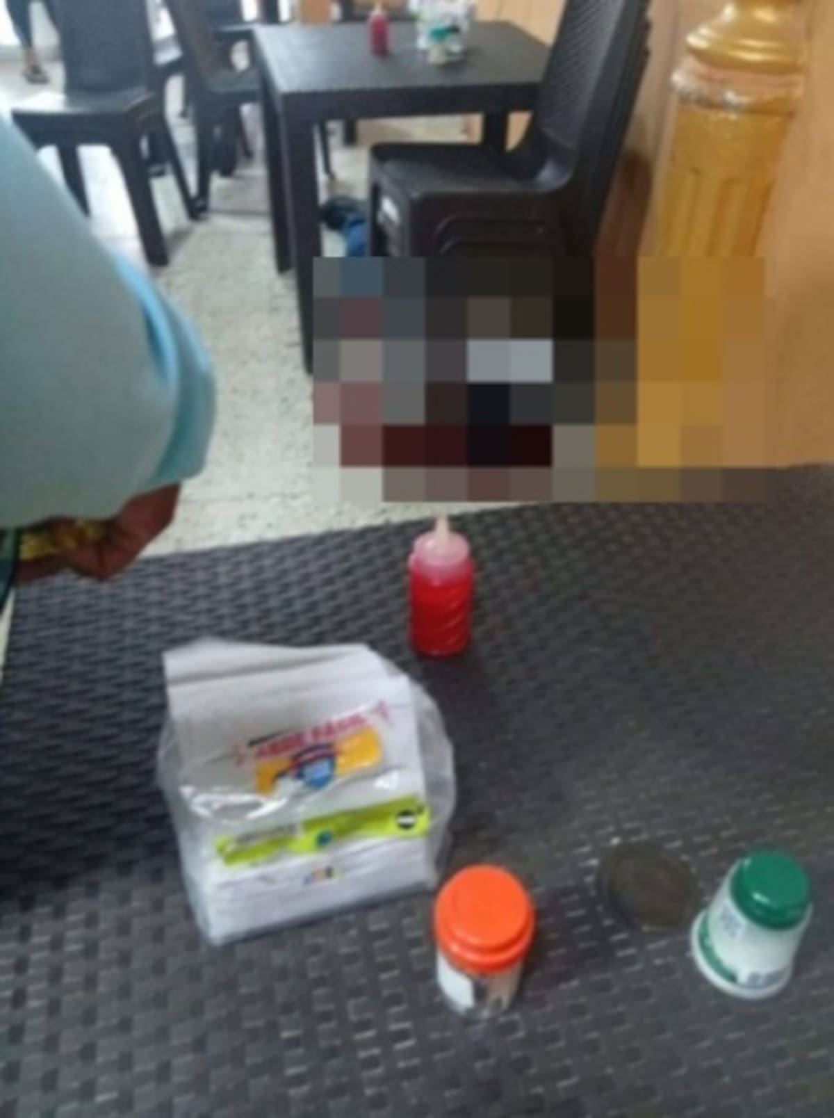 Homicidio en restaurante en El Bosque. // Foto de redes sociales