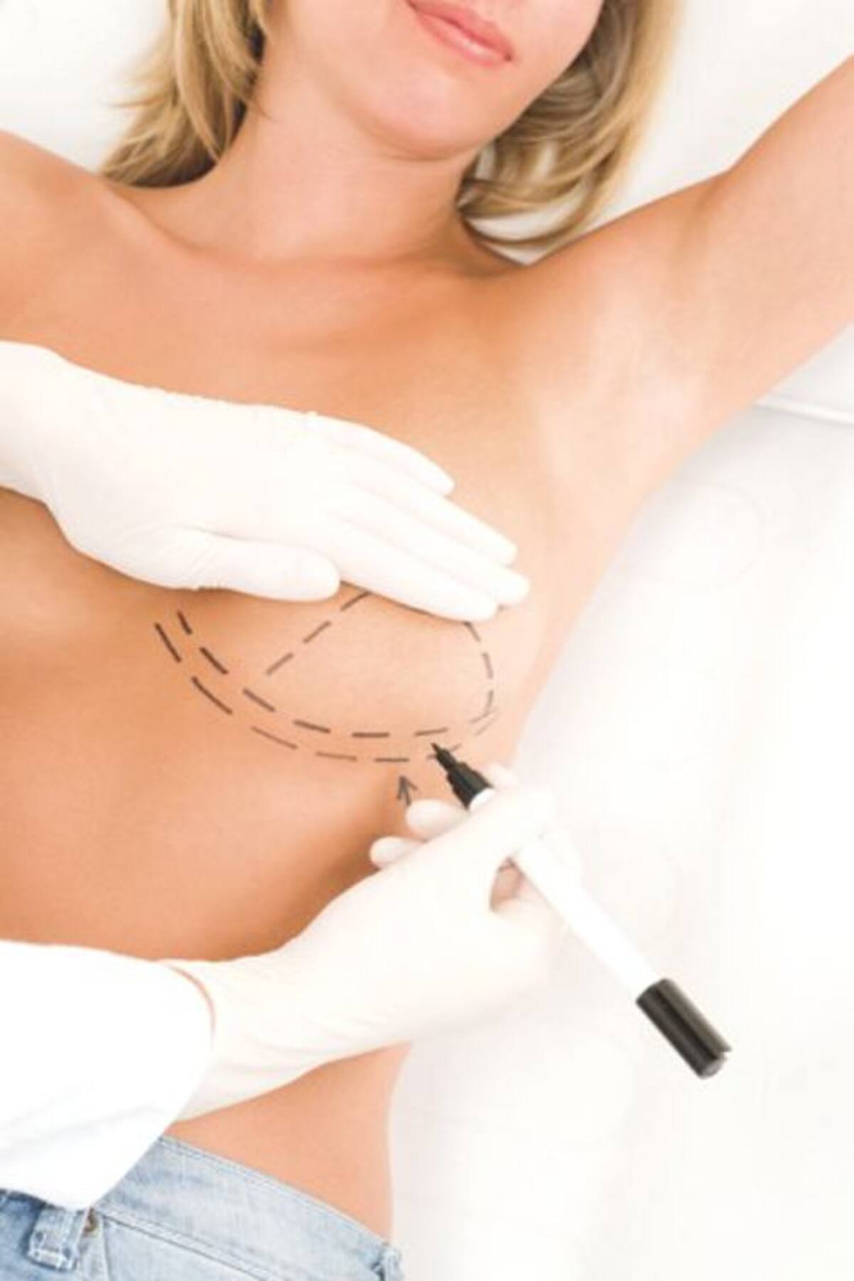 El especialista debe explicarle a la paciente las diversas funciones y beneficios de cada uno de ellos, y también indicarle el implante más adecuado para ella.