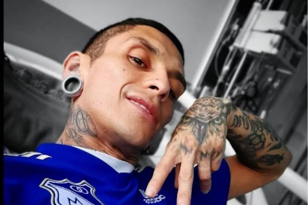 Osteomielitis: la infección de Javier Acosta, el hincha de Millonarios
