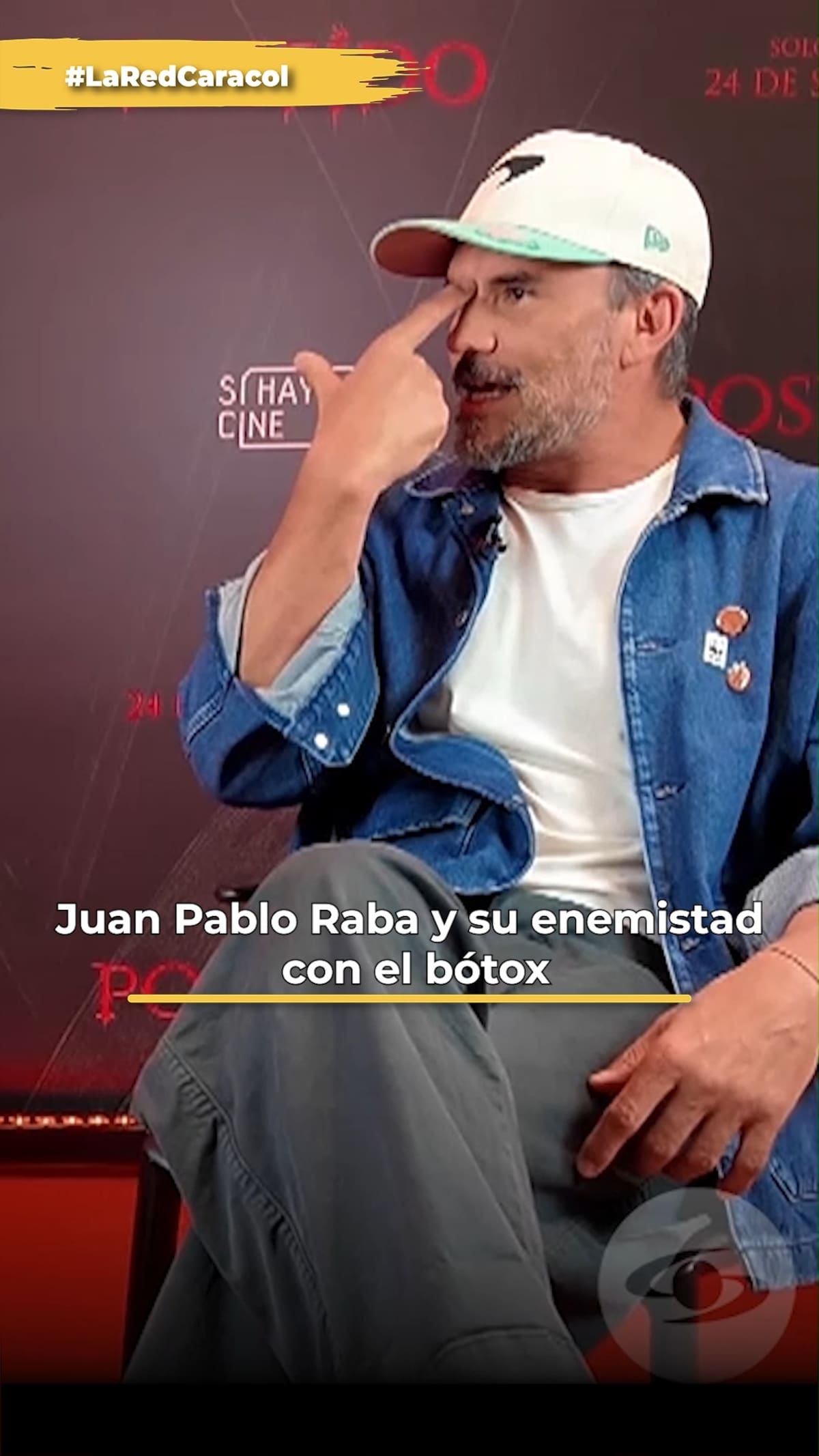 El actor recordó que el procedimiento alteró temporalmente sus expresiones faciales y aseguró que no volvió a utilizar esta sustancia.//Foto tomada de IG : @caracoltv, @marcovergarafz