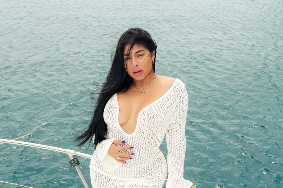 Karola mostró cómo quedó su cuerpo tras cirugía estética: ¿qué se hizo?