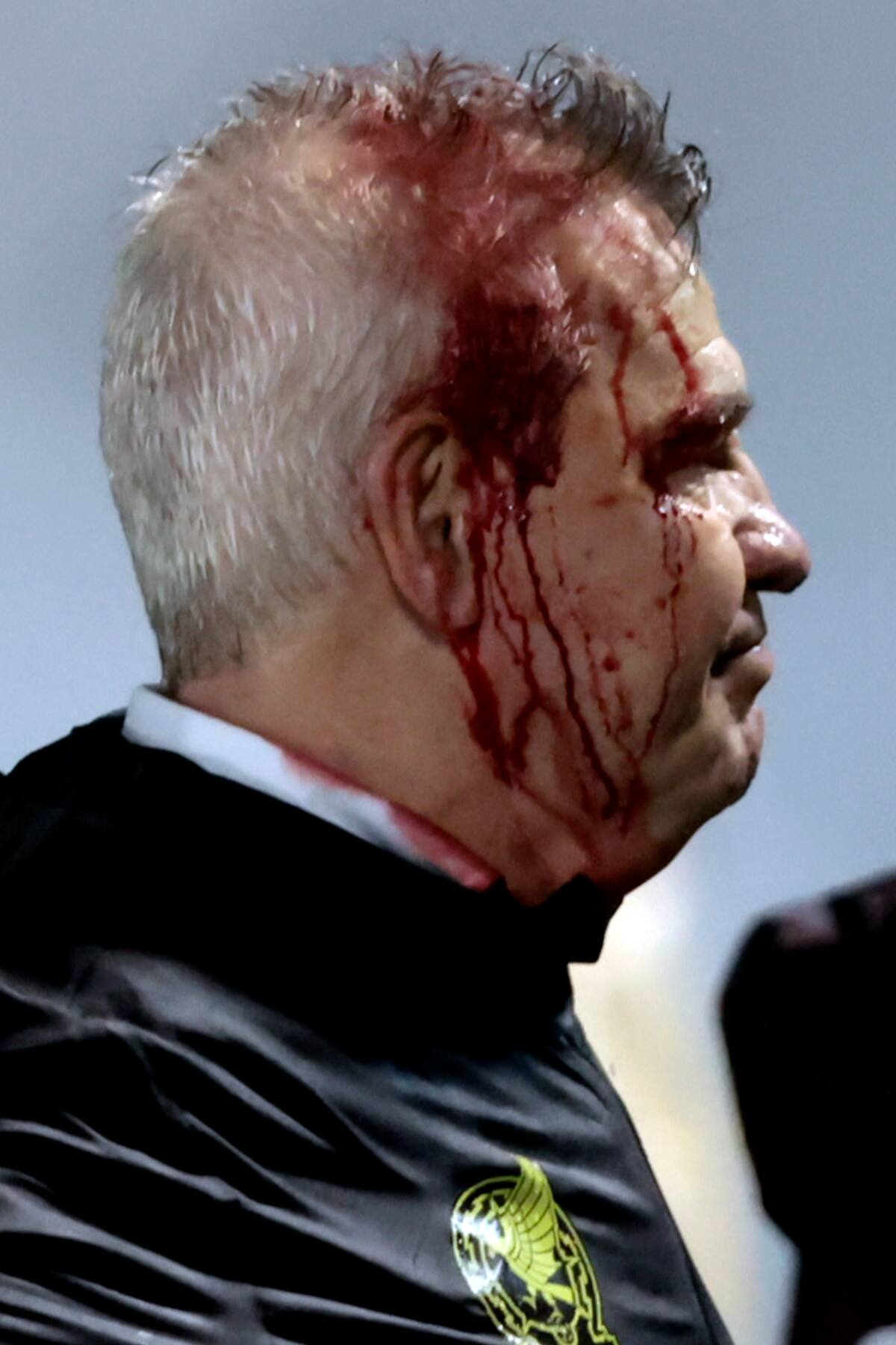 El seleccionador de México, Javier Aguirre, salió herido al final del partido del viernes ante Honduras. //EFE