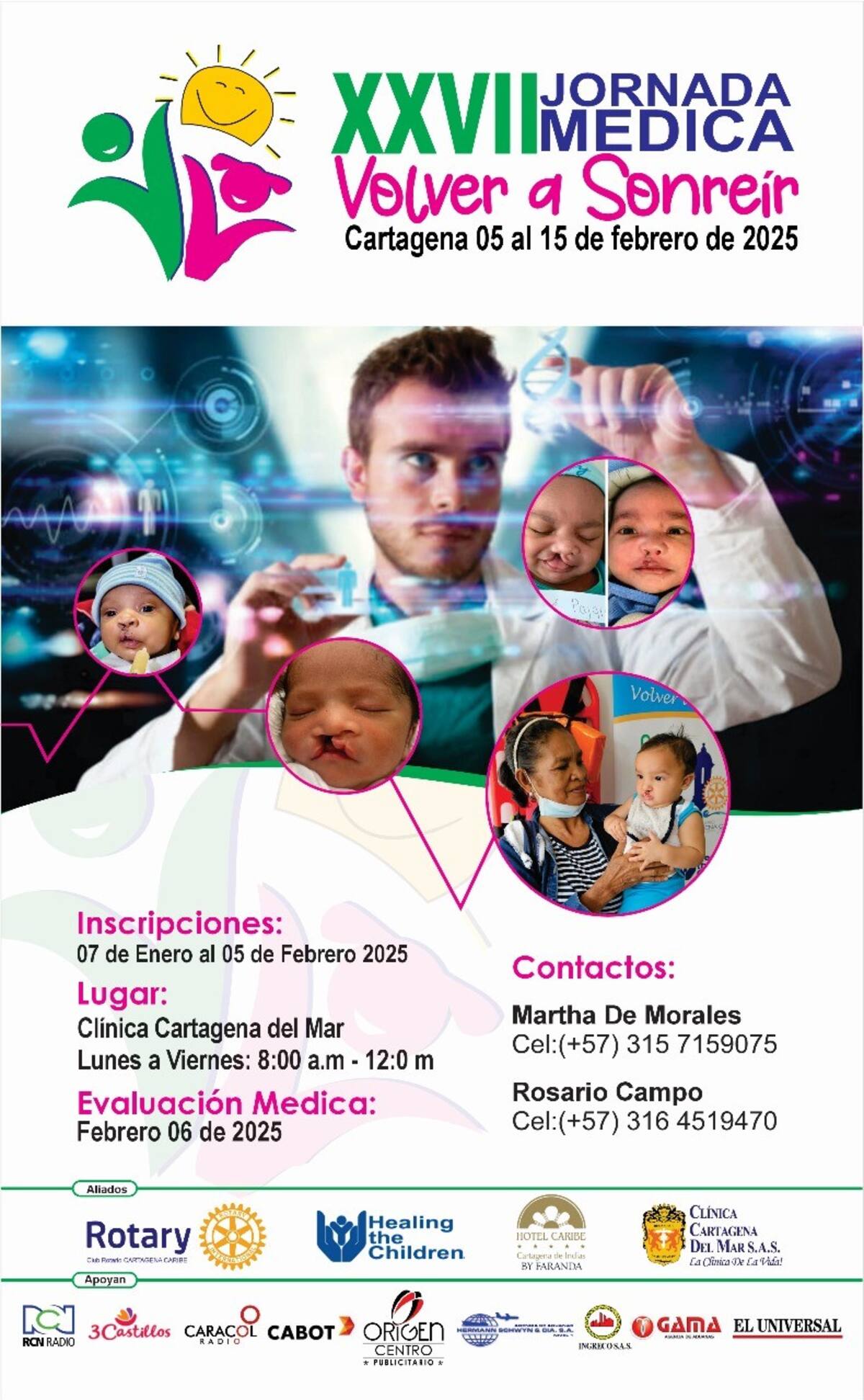 El Club Rotario Cartagena Caribe extiende la invitación a los padres de familia que tengan niños con labio leporino, paladar hendido, malformaciones congénitas en los dedos de manos o pies y quemaduras a que participen en la XXVII Jornada médica ‘Volver a sonreír’, que será del 5 al 15 de febrero en la Clínica Cartagena del Mar. //Cortesía.