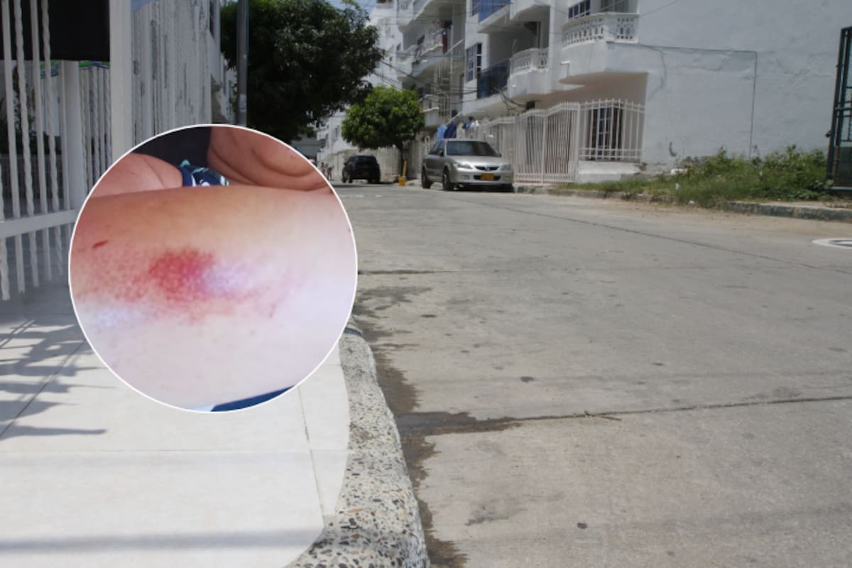 Ladrones tumbaron a una mujer en El Country para robarle la moto