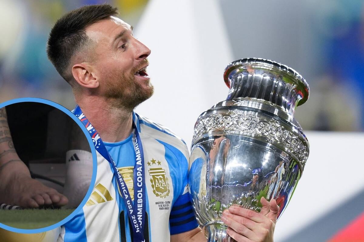 ¡Increíble! Venden llaveros con la forma del tobillo hinchado de Messi