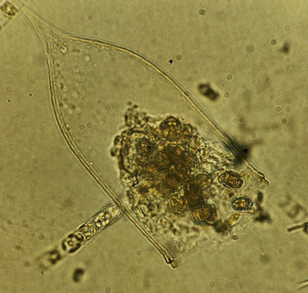La DIMAR confirmó que se observó la presencia de organismos microscópicos que se alimentan de microalgas. // Foto: cortesía - DIMAR