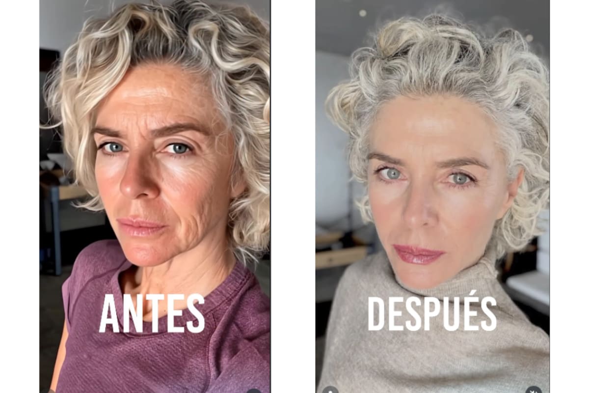 Margarita Rosa de Francisco publicó el antes y después de intervención. //Foto: captura de pantalla @margaritarosadefrancisco