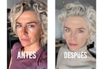 Margarita Rosa de Francisco sorprende con cambio en su rostro tras someterse a cirugía plástica