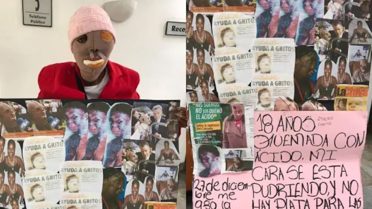 María Consuelo Córdoba, mujer que lleva dos décadas viviendo con las secuelas de un ataque con ácido de su exesposo. Foto: X: @PabloFuerman