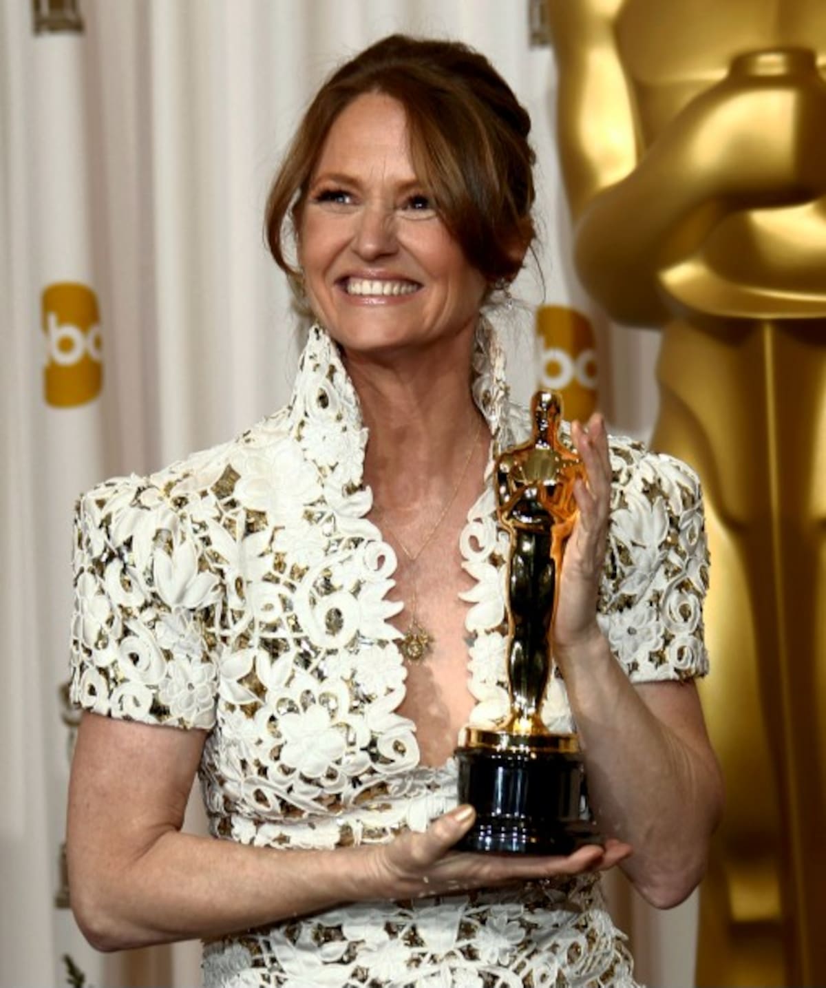Melissa Leo, Ganadora del premio a mejor actriz de reparto AP Matt Sayles