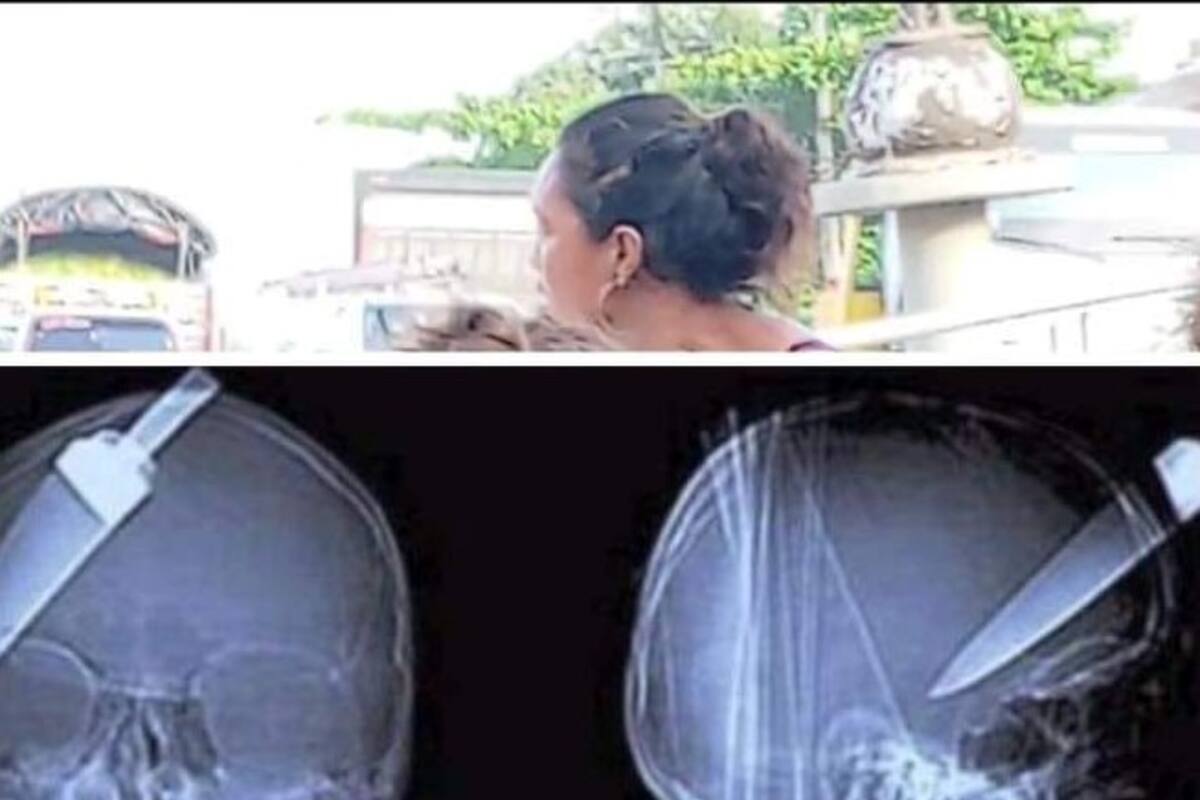¡Brutal riña! Le dejan incrustado cuchillo en la cabeza a una menor, de 14 años