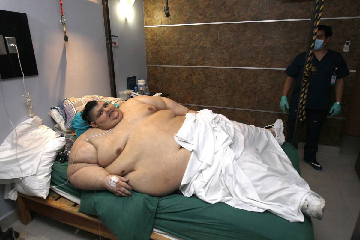 Fallece hombre reconocido por haber sido el más obeso del mundo: así lucía