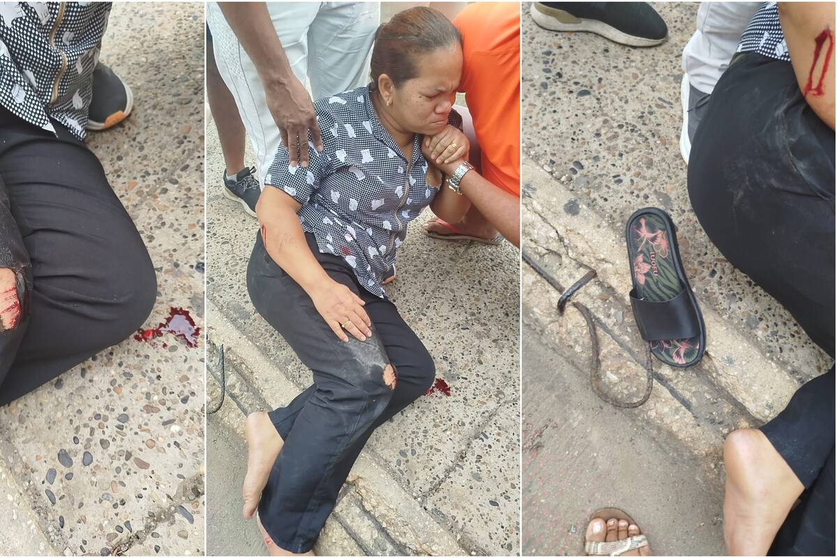 Mujer que cayó al suelo y Transcaribe golpeó quedó con 2 huesos fracturados