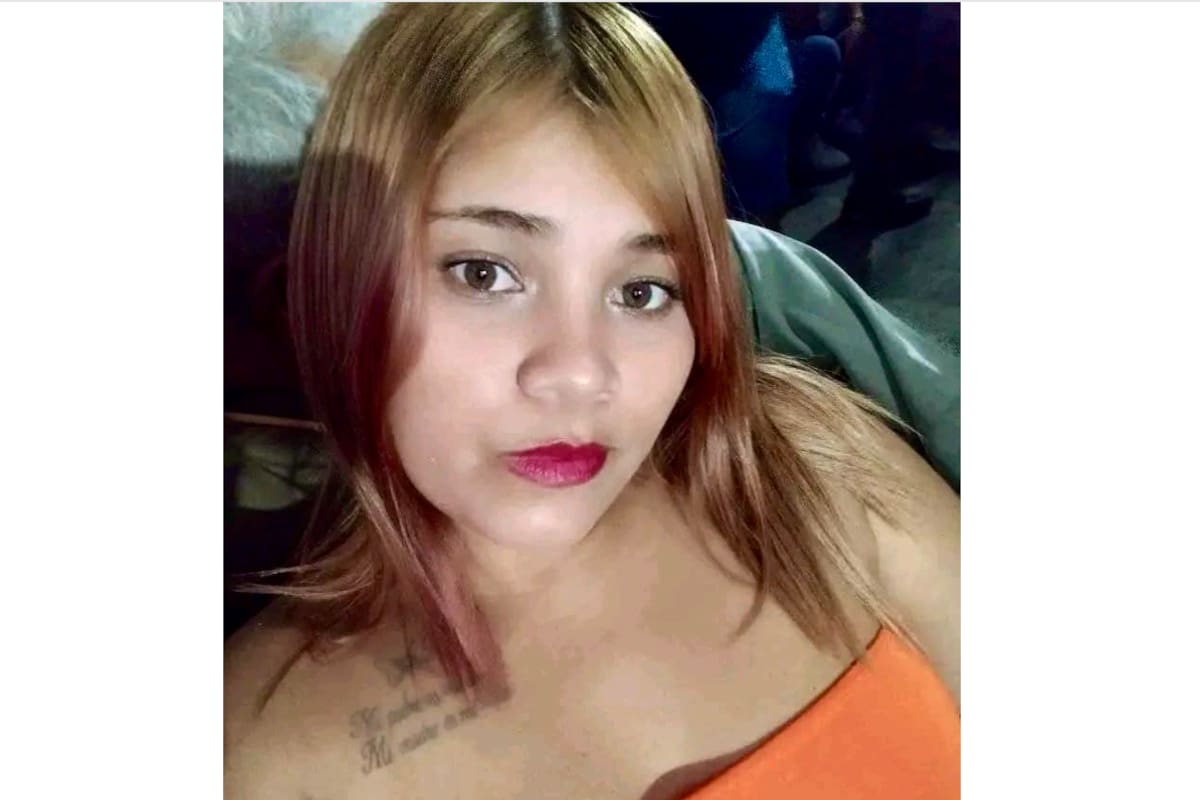 Nini Johana Torres, la joven que resultó herida al ser arrollada por una motocicleta