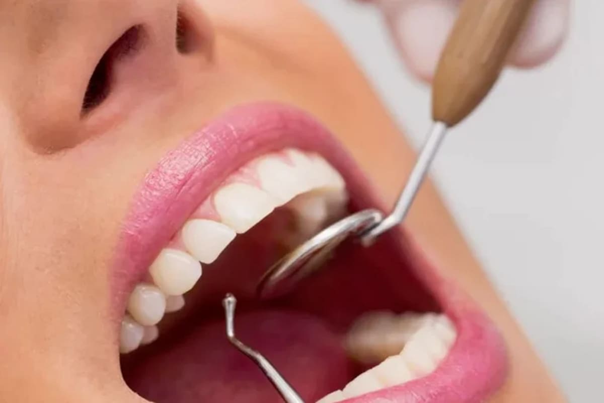 ¿Cómo prevenir enfermedades periodontales y sus riesgos para la salud?