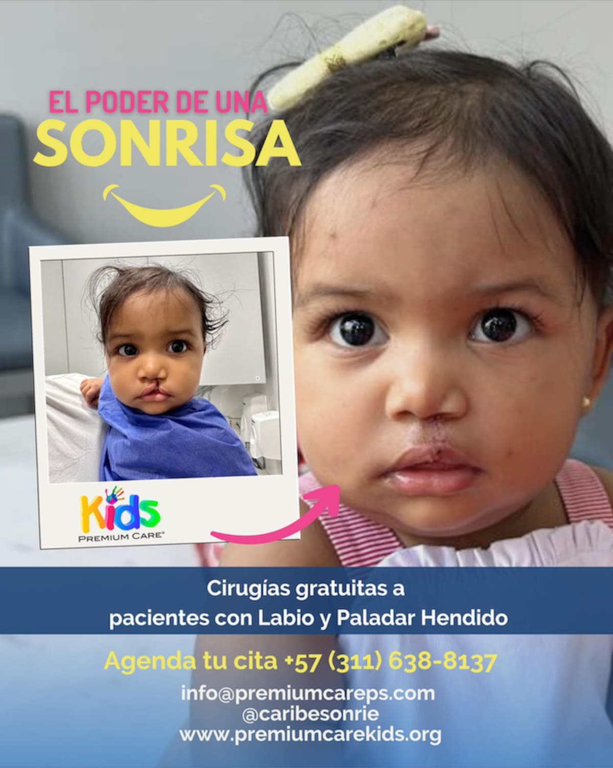 Este es el afiche promocional el programa Premium Care Kid, que por intermedio del equipo médico de Premium Care Plastic Surgery para brindar cirugías reconstructivas de labios leporinos completamente gratis.// Foto autorizada por Premium Care Kids.