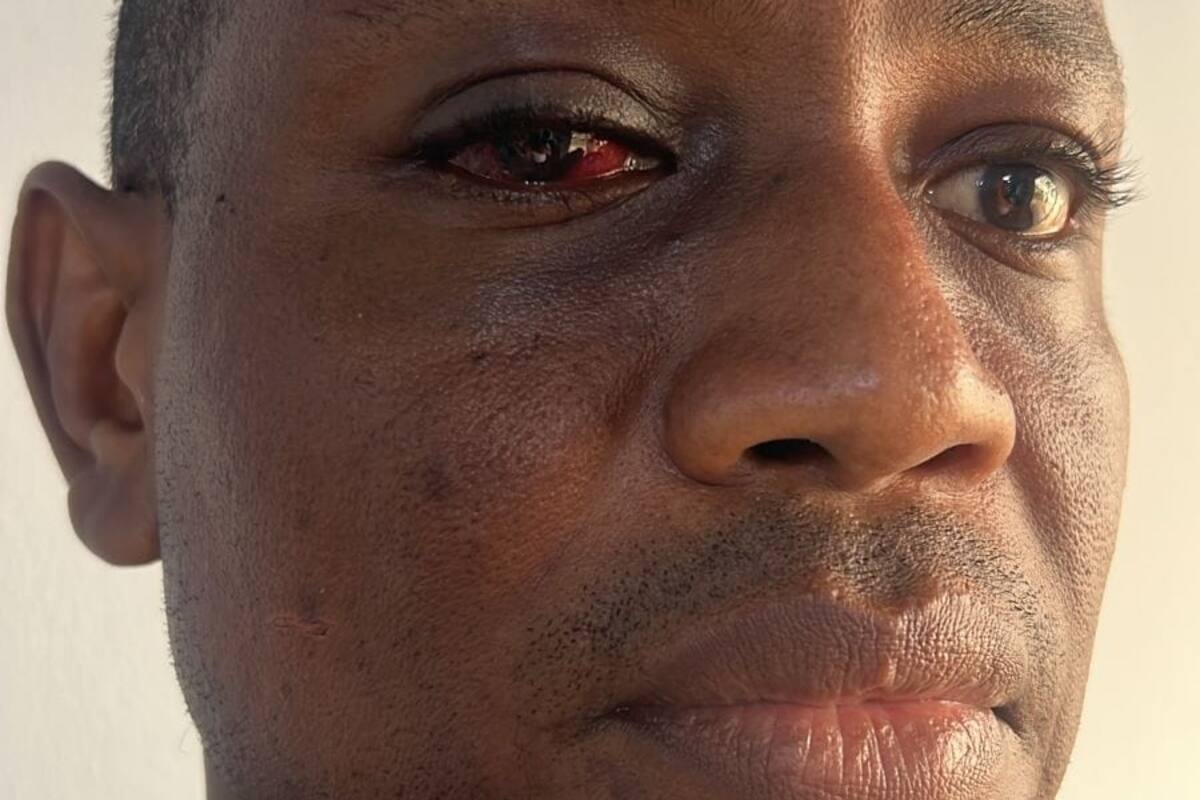 Video: denuncian a concejal de Marialabaja por agredir a periodista