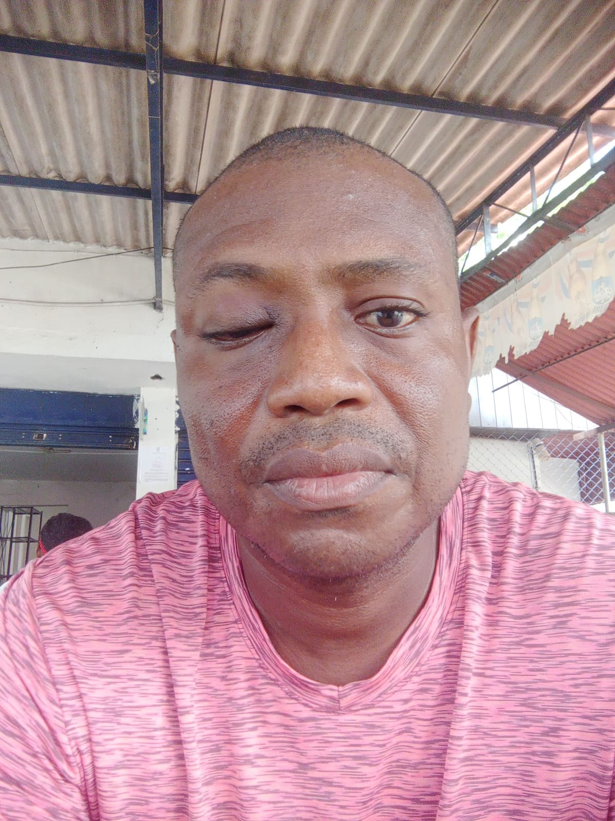 Orlando Mancilla, periodista agredido