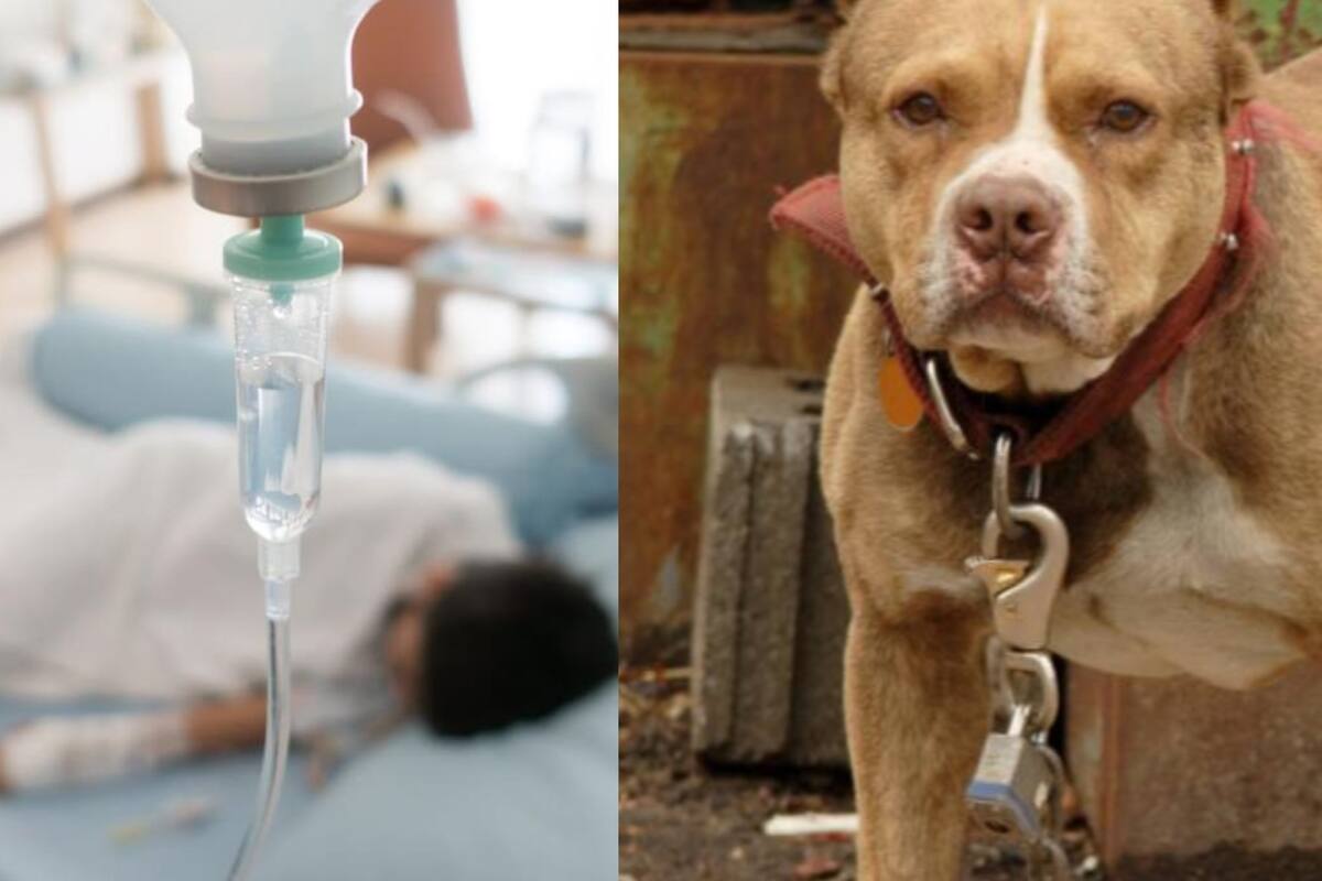 Pitbull ataca brutalmente a niño de 10 años y le causa graves heridas