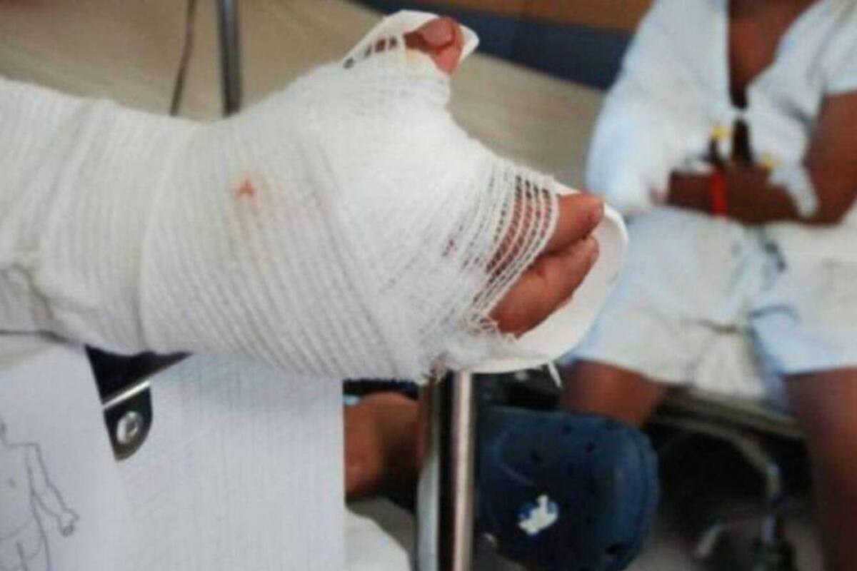 Crece cifra de quemados en Córdoba: ya van 31