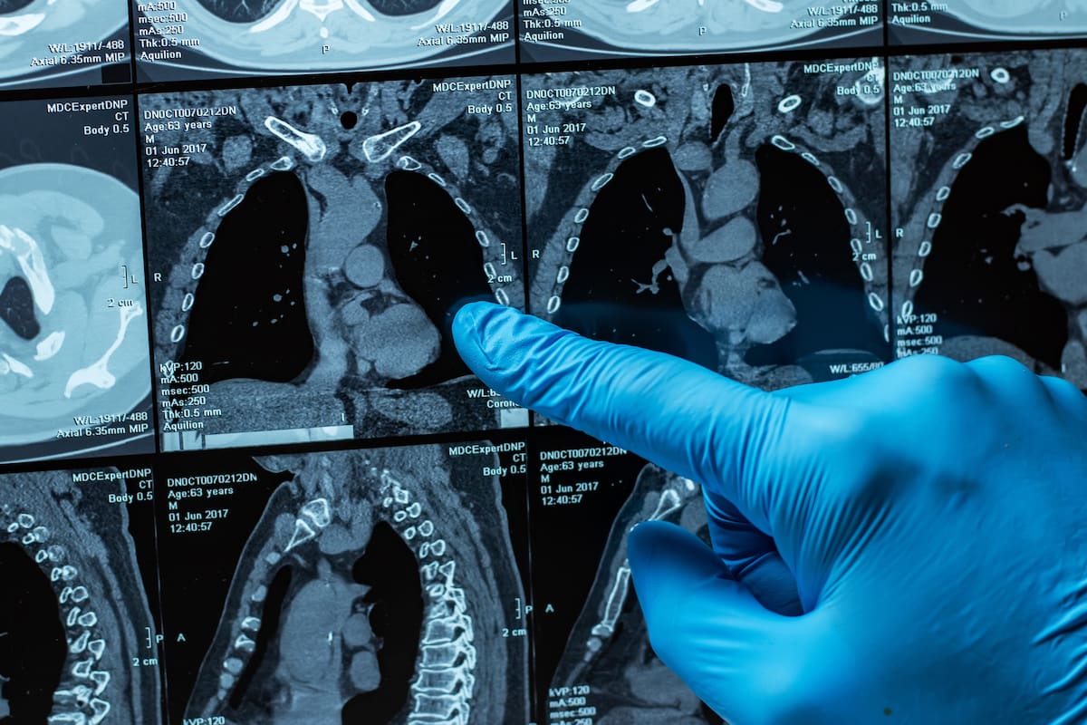 El nuevo equipo de Neurodinamia favorece diagnósticos más precisos. //123RF.