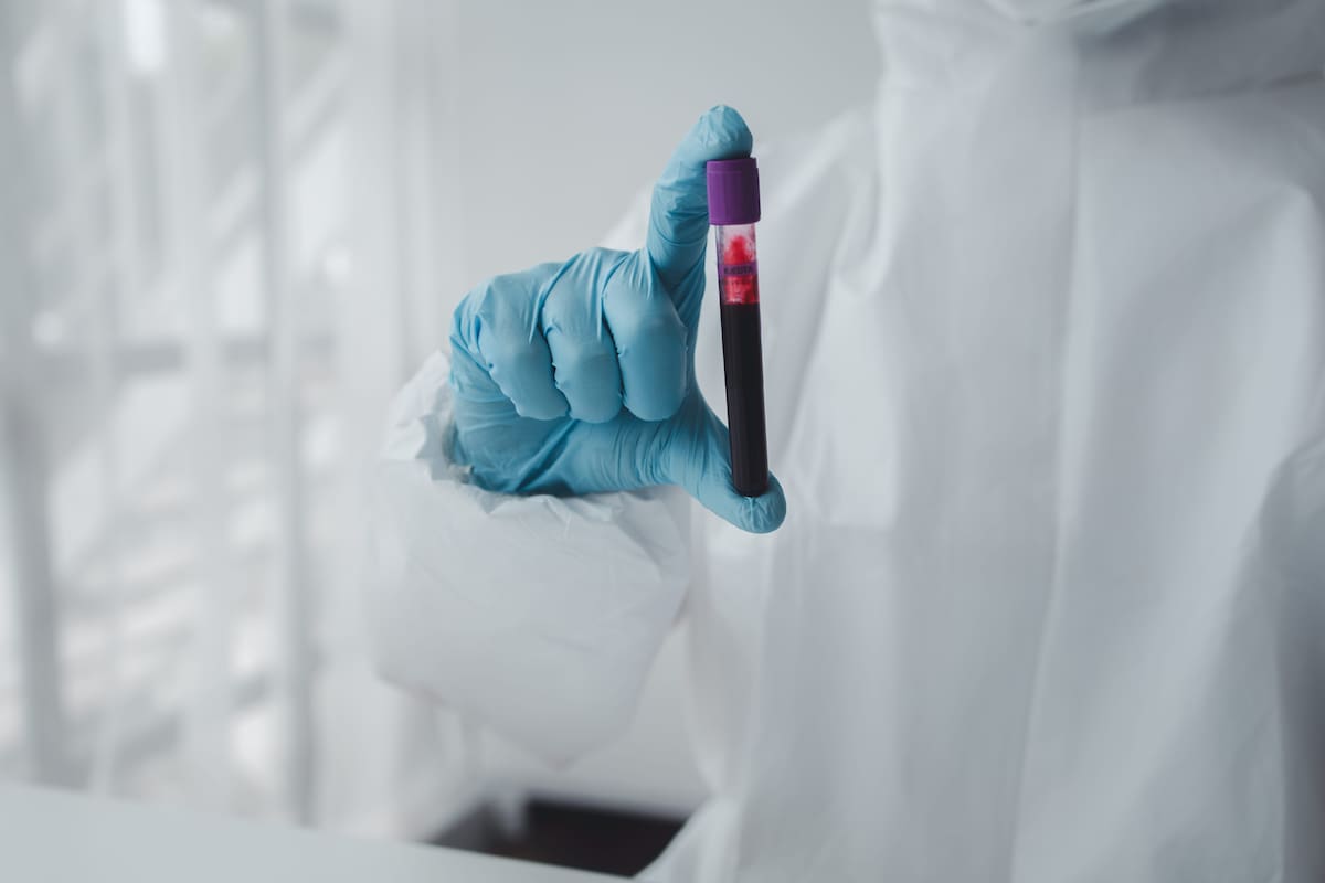 la tuberculosis no se contagia fácilmente por un contacto casual // 123RF.