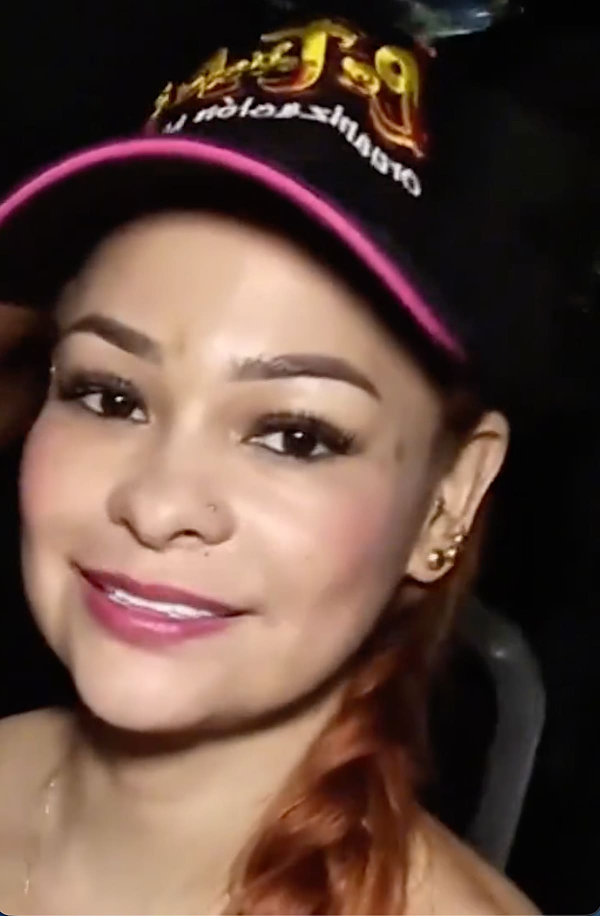 Yuleidys Fernanda Charris Reales, la mujer de que murió luego de complicarse tras una liposucción que se prácticó//Cortesía Red de Cooperantes.