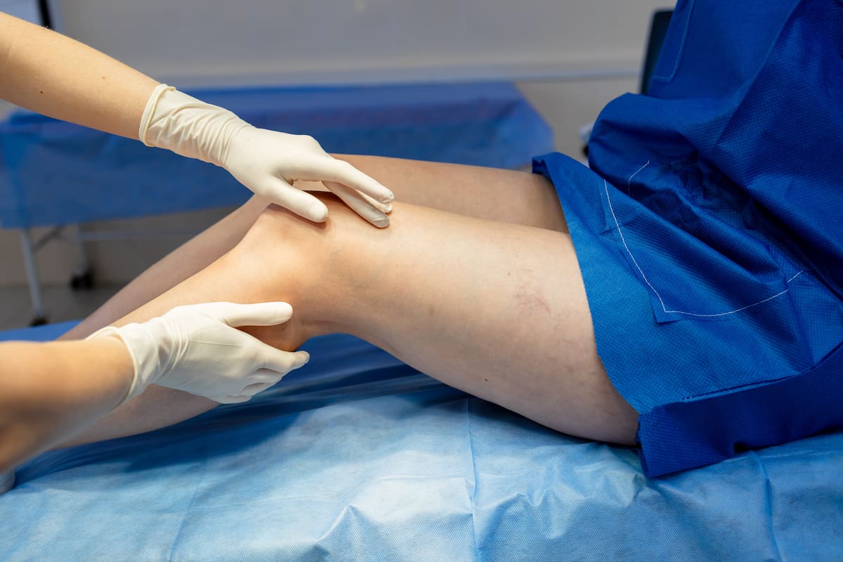 Colombia avanza en salud vascular. //Foto: 123RF.