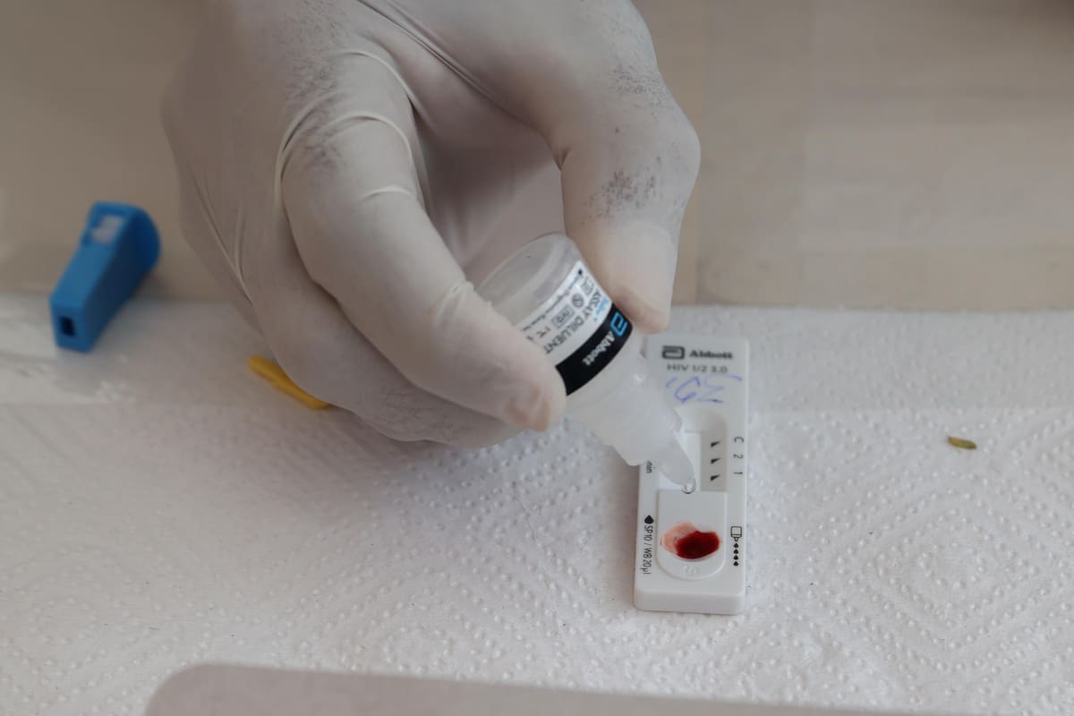 Colombia no registra aumento de nuevas infecciones por VIH en 2025