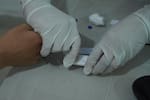 Test de sangre podría detectar el cáncer de páncreas en pocos minutos: así funciona