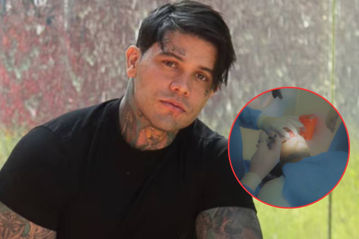 Yeferson Cossio sufrió accidente en el Amazonas, tuvo que ser operado de urgencia